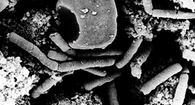 Bacteria of Siberian plague. Source: http://ru.wikipedia.org Bacteria of Siberian plague. Source: http://ru.wikipedia.org