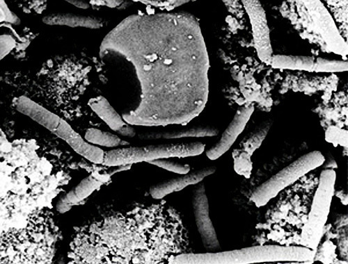 Bacteria of Siberian plague. Source: http://ru.wikipedia.org Bacteria of Siberian plague. Source: http://ru.wikipedia.org