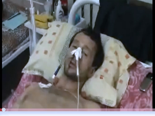 Vyacheslav Merekha after attack on him. Screenshot from a video cilp at www.youtube.com Vyacheslav Merekha after attack on him. Screenshot from a video cilp at www.youtube.com