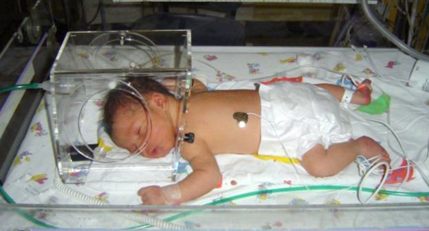 Newborn in incubator. Photo by croftsfamily.com Newborn in incubator. Photo by croftsfamily.com