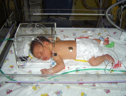 Newborn in incubator. Photo by croftsfamily.com Newborn in incubator. Photo by croftsfamily.com