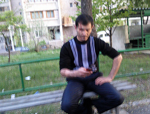Alexander Akhverdyan, an activist of the ANC, after being attacked; Yerevan, April 22, 2013. Courtesy of the http://www.ilur.am Alexander Akhverdyan, an activist of the ANC, after being attacked; Yerevan, April 22, 2013. Courtesy of the http://www.ilur.am