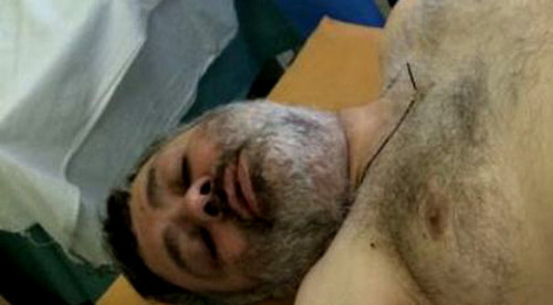 Batyr Pukhaev in the Republican Hospital of South Ossetia. August 2014. Photo courtesy of Indira Djioeva Batyr Pukhaev in the Republican Hospital of South Ossetia. August 2014. Photo courtesy of Indira Djioeva