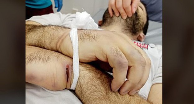 Traces of severe beatings on Inal Djabiev's body. Screenshot https://www.facebook.com/photo/?fbid=946507415829604&set=pcb.2721689724815819 Traces of severe beatings on Inal Djabiev's body. Screenshot https://www.facebook.com/photo/?fbid=946507415829604&set=pcb.2721689724815819