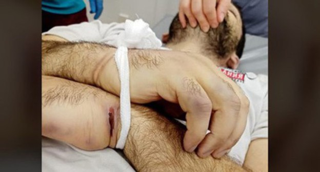 Bruises on Inal Djabiev's body. Screenshot https://www.facebook.com/photo/?fbid=946507415829604&set=pcb.2721689724815819 Bruises on Inal Djabiev's body. Screenshot https://www.facebook.com/photo/?fbid=946507415829604&set=pcb.2721689724815819