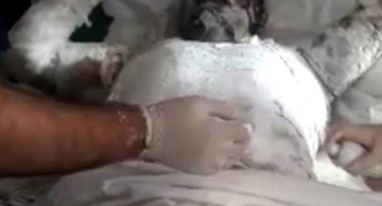 Tebriz Abdullaev, a participant in the Karabakh war, was hospitalized after a suicide attempt that he tried to commit near the building of the executive power in Azerbaijan. Photo https://vk.com/wall-51605285_1583184 Tebriz Abdullaev, a participant in the Karabakh war, was hospitalized after a suicide attempt that he tried to commit near the building of the executive power in Azerbaijan. Photo https://vk.com/wall-51605285_1583184