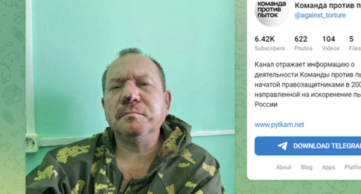 Igor Kalyapin in the hospital. Photo https://t.me/s/against_torture/2203 Igor Kalyapin in the hospital. Photo https://t.me/s/against_torture/2203